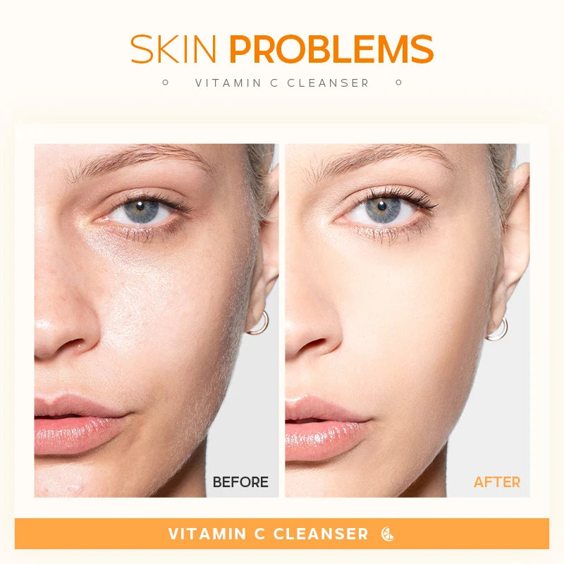 Limpador Facial LAIKOU Vitamina C – Limpeza Profunda, Iluminação e Controle de Oleosidade